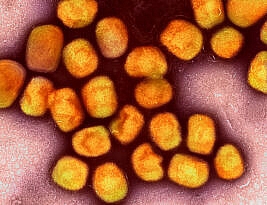 WHO Declares Monkeypox a ‘Global Health Emergency’